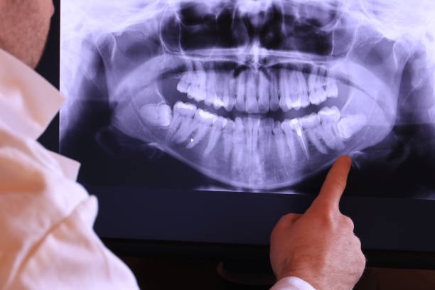 Best Root Canal Emergency Dentist  in Russells Point, OH