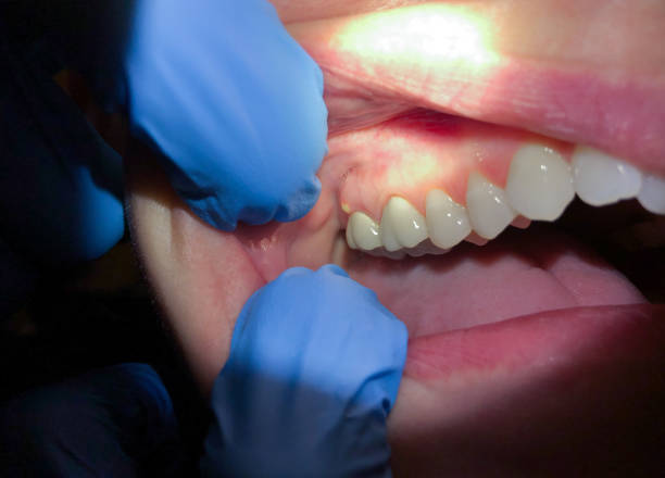 Best Teeth Whitening  in Russells Point, OH