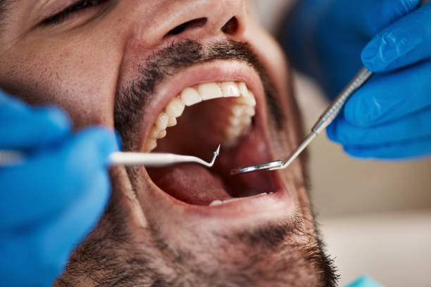 Best Dentist for Tooth Abscess  in Russells Point, OH