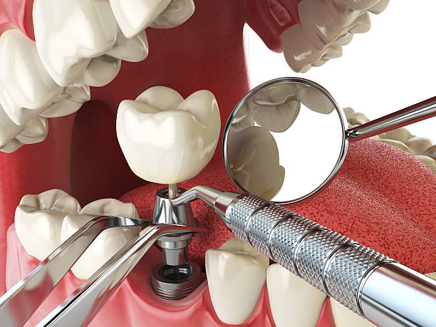 Best Affordable Emergency Dental Care  in Russells Point, OH