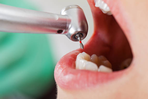 Best Affordable Emergency Dental Care  in Russells Point, OH